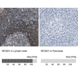 RCSD 1 Antibody, Novus Biologicals 25 &mu;L, Unlabeled:Antibodies, Polyclonal